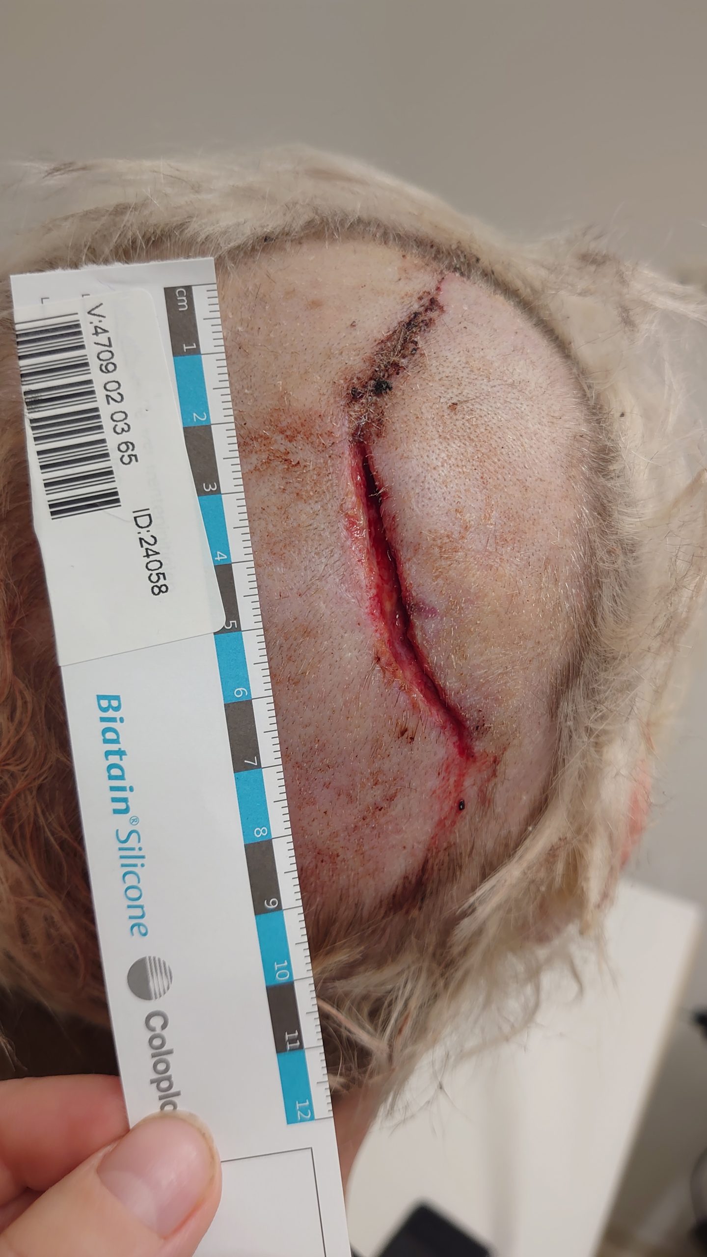 Ausgangssituation Renate B