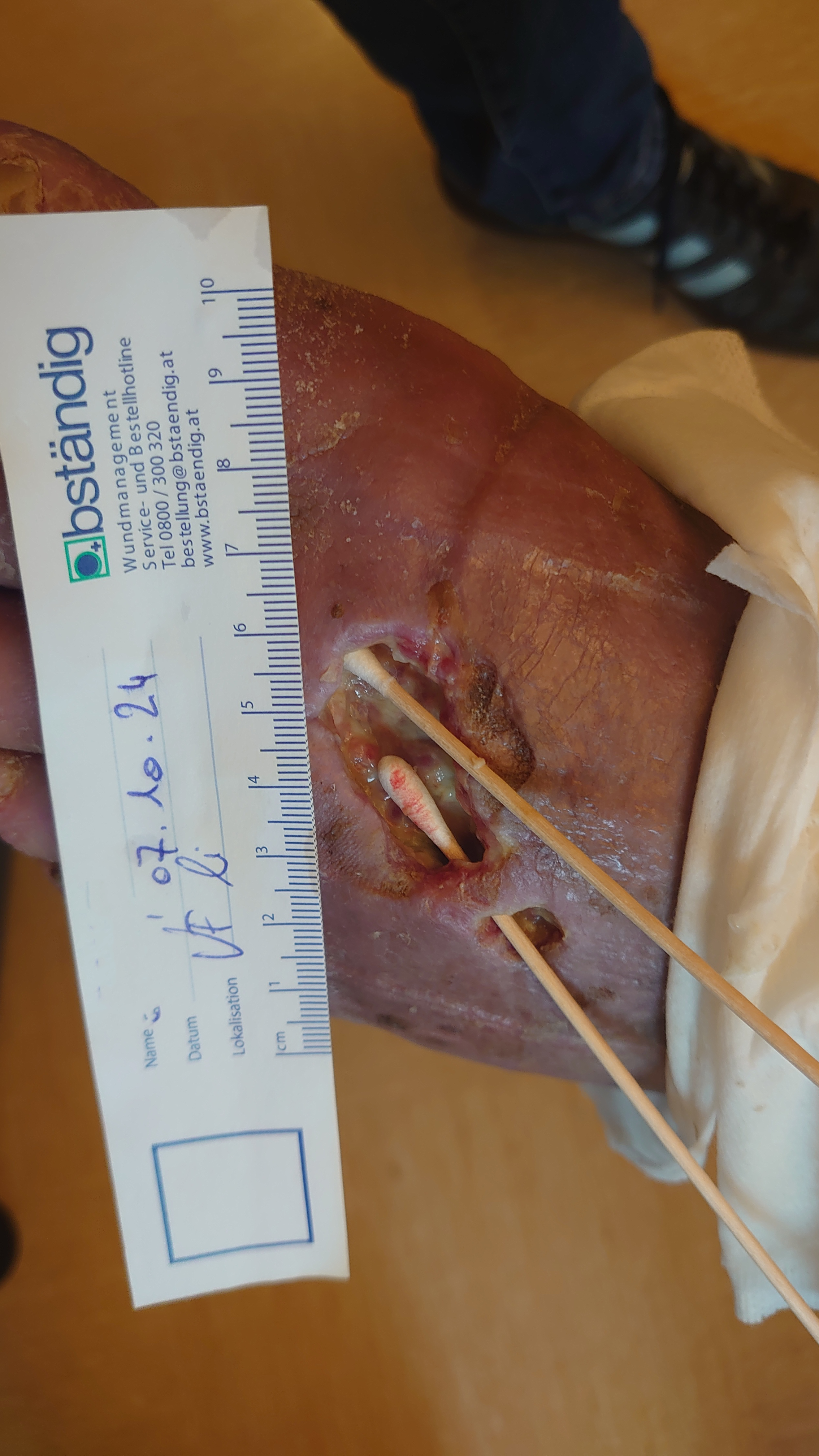 Ausgangssituation Wunde Johann G